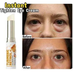 Crème anti-cernes instantanée pour les yeux, élimine les poches sous les yeux, les cernes, les poches, estompe les ridules, éclaircit, beauté coréenne