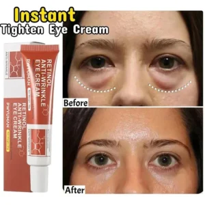 Crème pour les yeux anti-graisse instantanée, élimine les poches sous les yeux, les cernes, les poches, estompe les ridules, éclaircit, beauté coréenne